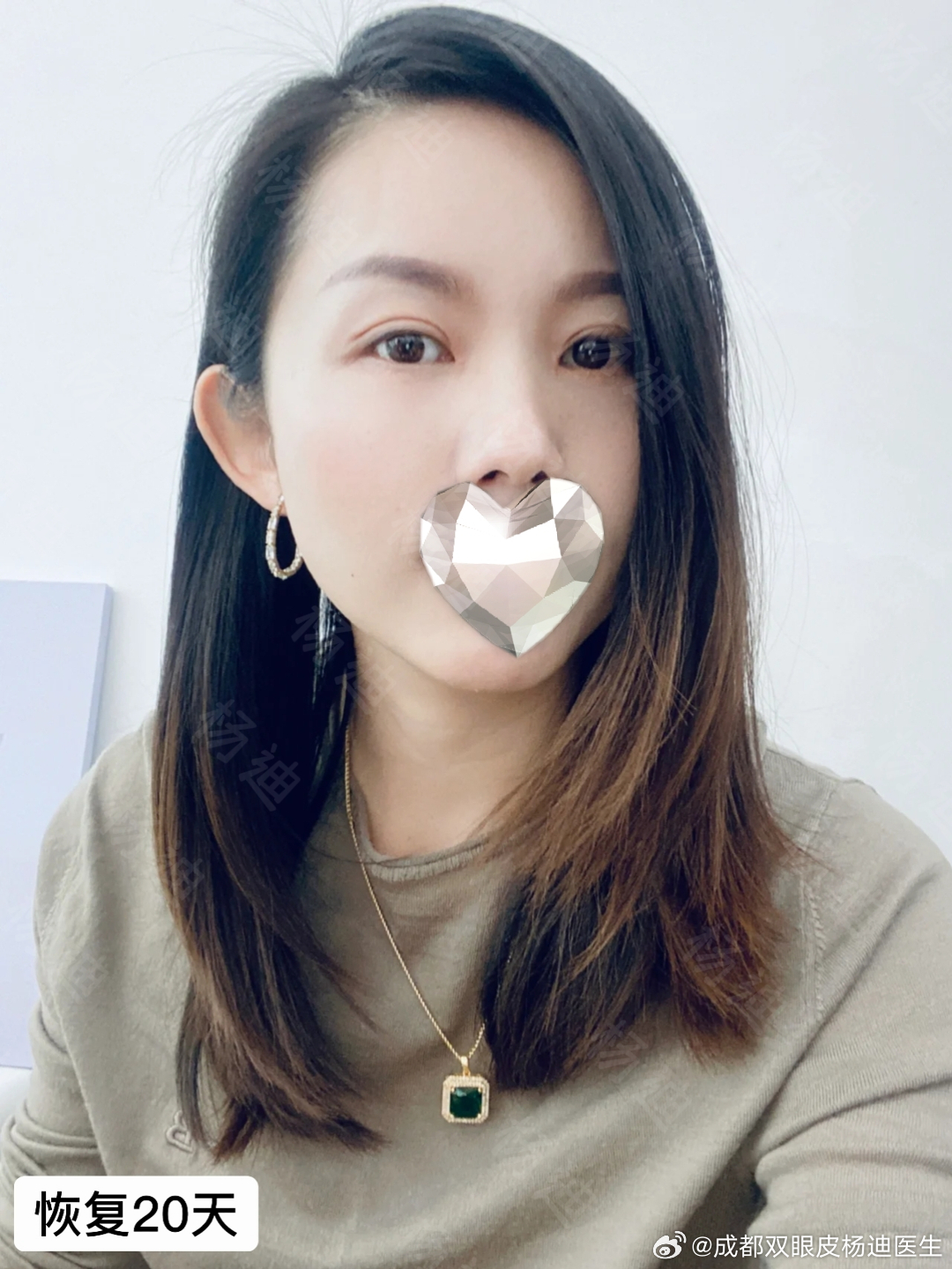 眼部整形新技術(shù)介紹與探討