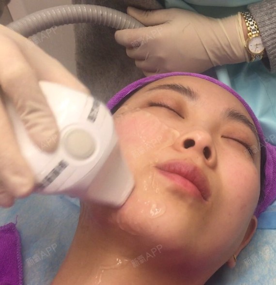 最新溶脂技術重塑自信人生旅程